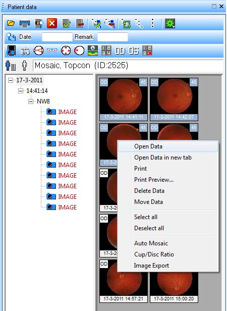 eller O B S Välj i alternativ Close window after opening items (Stäng fönster efter öppnande av objekt) för