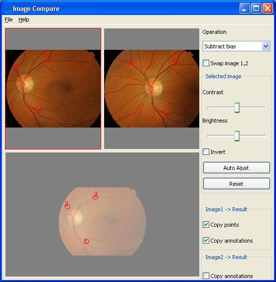 Topcon Europe Medical BV