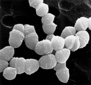 MRSA Shift mot mer och mer resistenta bakterierakterier i VRI ESBL tarmbakterier VRE