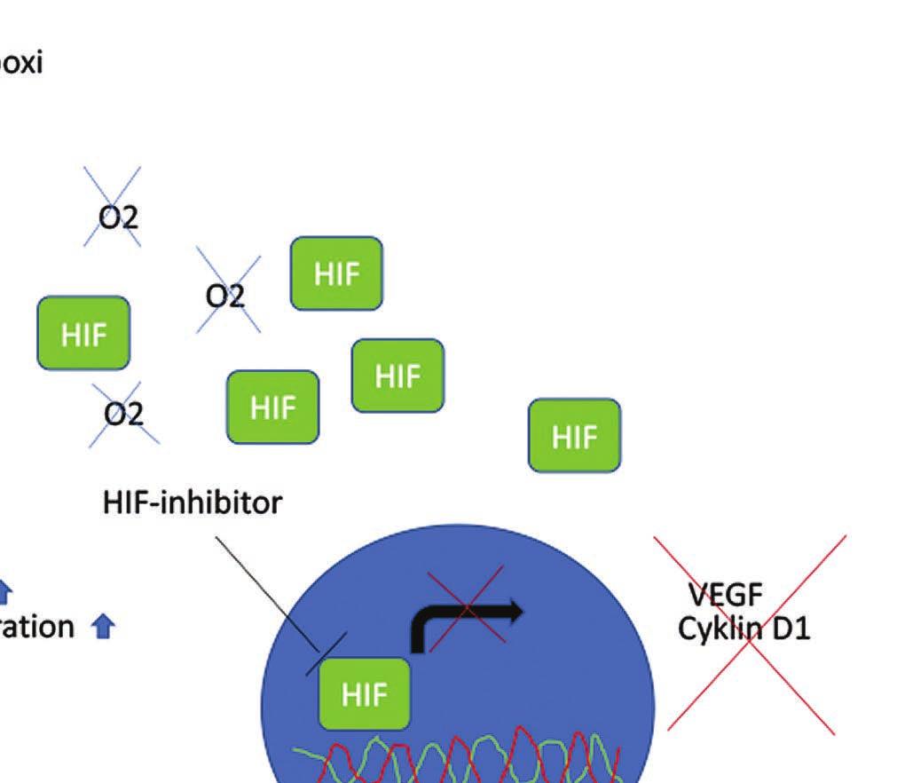 I hypoxiska tumörer är HIF1-aktivitet också hög (C).