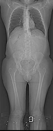 Radiology - Overview Cardiac Calcium score Coronary angiography 3mSv Pulmonary High resolution CT