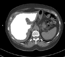 Paracrine Systemic(?