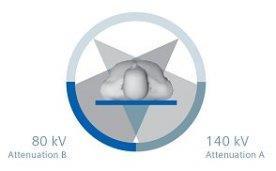 Computer tomography (CT) Development Time-resolution Radiation Dual-energy