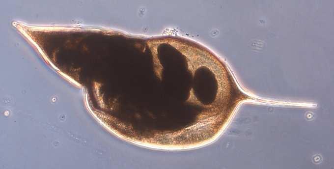 0% 30B Hammarsjön 109 Möckeln 9 Osbysjön 28B Råbelövssjön Hammarsjön hade ett avvikande planktonsamhälle, med relativt få arter växtplankton och mycket liten mängd djurplankton (Figur 21).