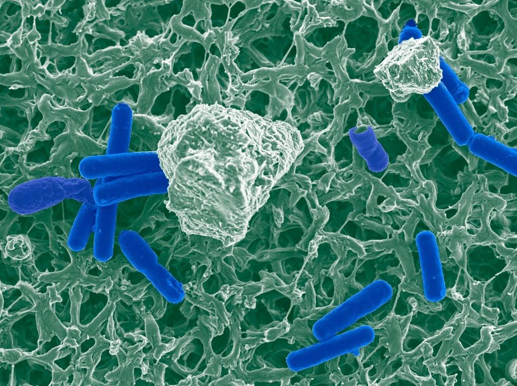 Välkomna till webbinarium om Clostridium difficile-infektion