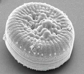 1989; Battarbee et al. 1999). Figur 4. Foton av kiselalger tagna i svepelektronmikroskop. Överst Cyclotella comensis, i mitten Tabellaria binalis och längst ner Brachysira vitrea.