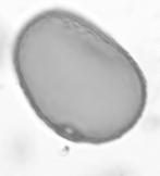 Pollenpreparaten applicerades på objektglas tillsammans med safraninfärgad glycerin, täcktes med täckglas och räknades i mikroskop i 200x förstoring.