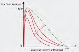 Vid obstruktion av de perifera luftvägarna ökar residualvolymen (RV), det vill säga den gasvolym som kvarstår efter en maximal utandning samt dess andel (RV/TLC %) av den totala lungkapaciteten (TLC).