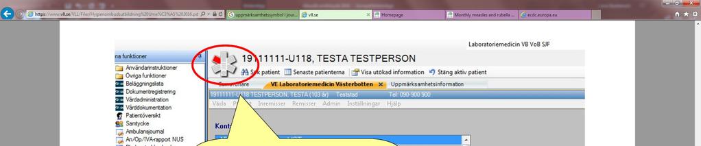 VRE vancomycinresistenta enterokocker Spridning har skett på våra tre sjukhus, sprids via händer in i munnen eller till sår Allra flesta är symtomfria bärare Drabbat