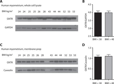 BMI och oxytocinreceptorn Correlation of myometrial oxytocin receptor gene