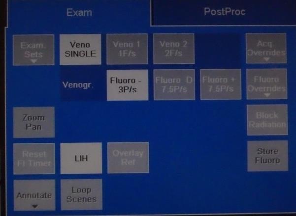 Uppdukning av sterilt bord Material som används dukas upp på ett assistansbord. Drag upp bedövningsmedel Carbocain 10 mg/ml i 4 st 10 ml sprutor med Luer-lock fattning.