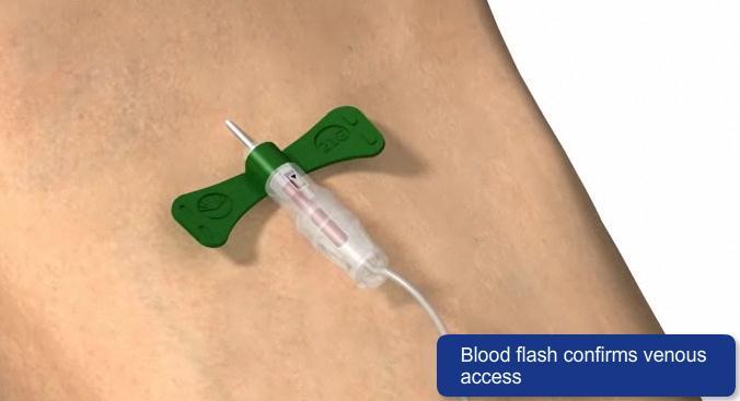 13. BD Vacutainer Push Button blodprovtagningsset Denna modul förklarar egenskaperna av BD Vacutainer Push Button venprovtagningsset.