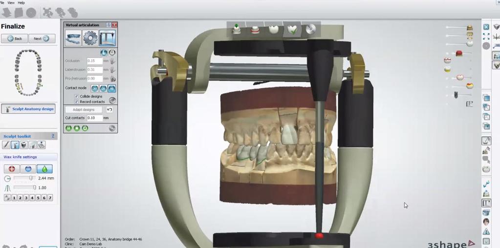 Vi på BN-Dental erbjuder den senaste tekniken inom Cad/Cam vars utveckling går oerhört fort, speciellt inom zirkoniumbaserade konstruktioner där många nya material lanserats.