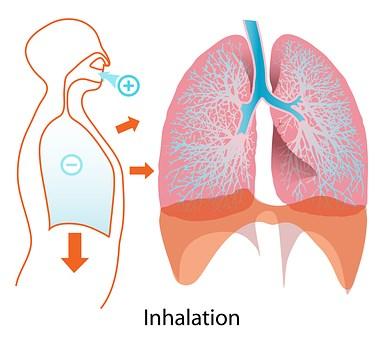 Arbete Miljö Medicin Sida 5 Inandade nanopartiklar - skillnader i upptag et finns en tydlig koppling mellan akut förhöjda D luftföroreningsnivåer och plötslig död (dvs. dödsfall inom något dygn).