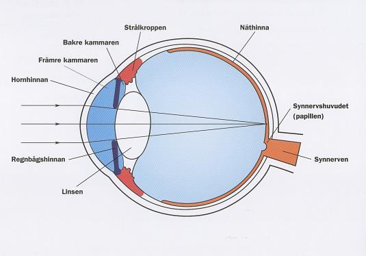 GLAUKOM grön starr Okulär hypertoni : Högt ögontryck utan synfältsskada Öppenvinkel glaukom : Kronisk sjukdom Livslång behandling