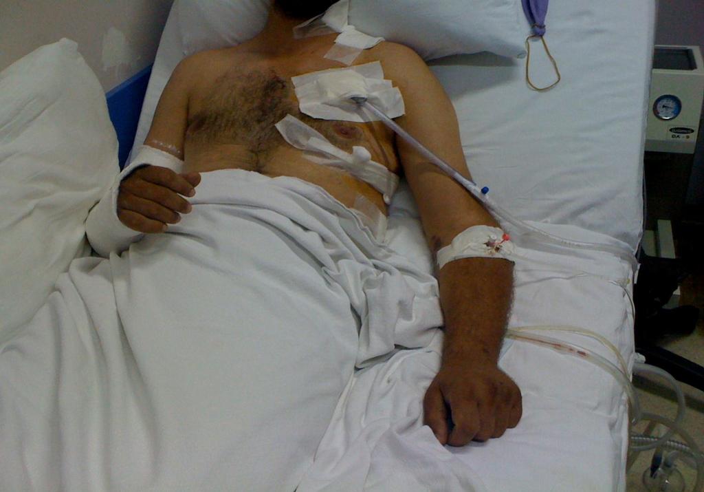 Skottskadad från norra Syrien på sjukhus i