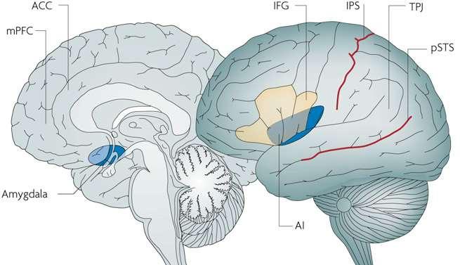 The Brain Gyrus Anterior Cingulate Cortex och Ventromedial Prefrontal Cortex kan ge information om riktade interventioner vid AST (Balsters JH, 2017) Connectivity, Långa och korta konnektioner.