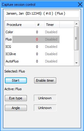 Gumb»Start timer«[»vključi časovnik«] se pojavi, ko omogočite časovnik.