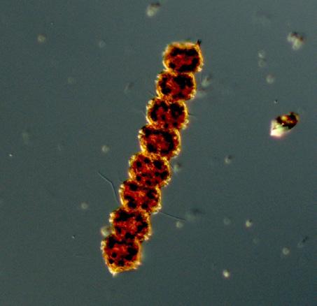 BY5 17 th of April A lot of ciliates were found in the sample together with high cell concentrations of the diatoms Chaetoceros similis, Thalassiosira baltica and the dinoflagellate Peridiniella