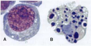 Cellmorfologi vid apoptos