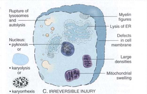 Nekros Nekros - förändringar Cell- eller vävnadsdöd orsakad av externt trauma som t ex mekanisk skada eller syrebrist (hypoxi) Cell och organell svullnad, ATP