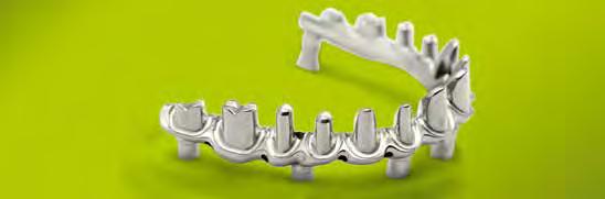 Createch for Straumann Customized prosthetic solutions. Individual excellence and efficiency on demand. Stands for high-quality screw-retained bars and bridges for fixed and removable prosthetics.