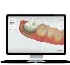 How easy it is to do the intraoral scanning Demonstration of 3Shape Trios scanner Finland 15 February Helsinki 16 February Oulu Norway