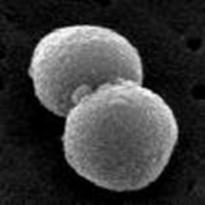 cytostatika) Bakterier: Streptococcus pneumoniae ofta orsak till lunginflammation