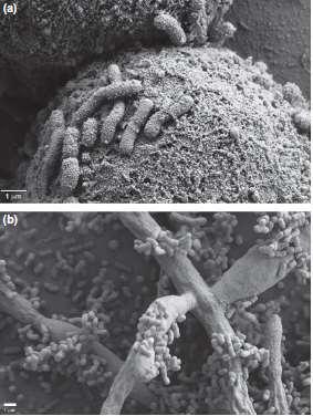 Acinetobacter baumannii McConnell