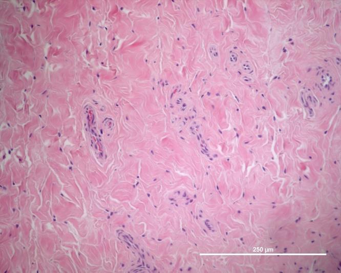 Med den HE färgning som gjordes för att studera preparaten kunde ej vilken typ av celler som uppvisade fluorescens bestämmas. Figur 6a: Representativ immunofluorescensinfärgning av normal ledkapsel.