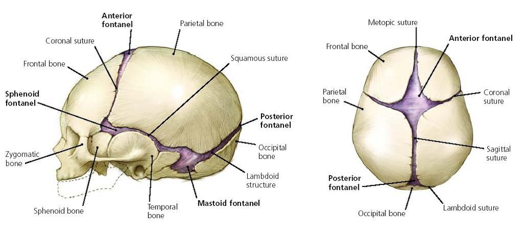 Fontanell Stor fontanell eller sen slutning Fontaneller slutar sig mellan 8 mån och 3 år Storlek varierar från 0,5 x 0,5cm