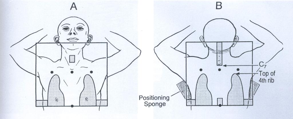 Äldre Hodgkin-behandling: