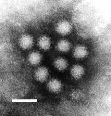 Vinterkräksjuka Orsakas av Calicivirus Norovirus Sapovirus Inkubationstid 1-2 dygn Symptom: Illamående,