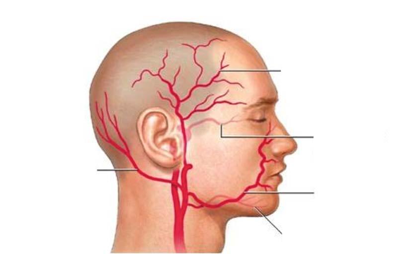 Temporalarterit Drabbar ofta segment av a.