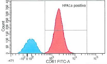 Trombocyter, HPA-1a typing Studentprojekt 400 Buffycoat trombocyter testades (poolade från 4 givare,