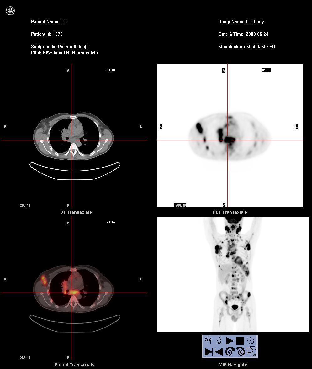 PET/CT