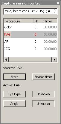 Knappen Starta timer visas när timern aktiveras. Radera bilder under fångst Fig.