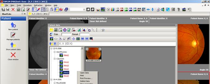 data. eller Obs, välj i alternativ Close window after opening items