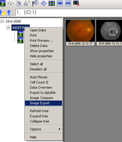 Modulplugins kan ta mot data och patientuppgifter från IMAGEnet i-base och alternativt skicka data tillbaka till IMAGEnet i-base.