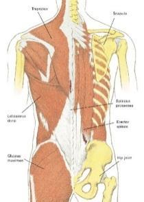 Muskel bristningar Muskelbristningar i muskler som går över två leder Hamstring bristning är allt vanligare