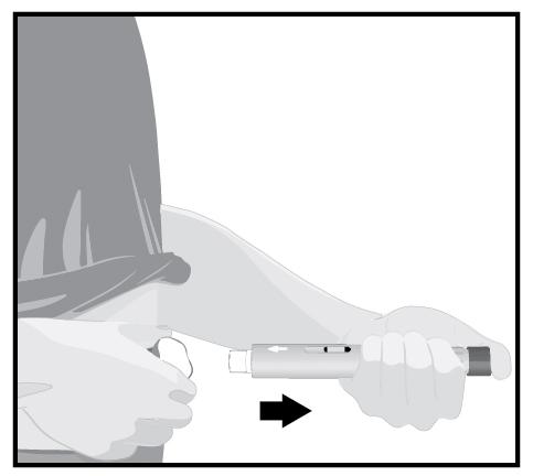 STEG 8 Lyft långsamt injektionspennan från huden när injektionen är klar. Det vita nålskyddet kommer att åka ner över nålspetsen.