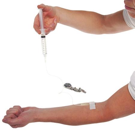 Håll armen rak och stilla under infusionen. När injektionen är klar finns det en liten mängd läkemedel kvar i venpunktionssetet, men det påverkar inte din behandling.