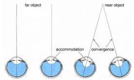 improves: visual acuity reading in low contrast