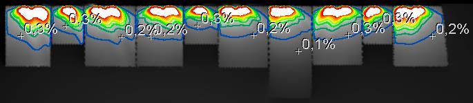 Dagsljusfaktor (%) Sida 30 (34) 3.6.2. Hus D plan 1 2 1,8 1,6 1,4 1,2 1 0,8 0,6 0,4 0,2 0 Hus D plan 1-60% -73% -40% -67% -67% -70% -67% -57% -60% -60% D-1.1 D-1.2 D-1.3 D-1.4 D-1.5 D-1.6 D-1.7 D-1.