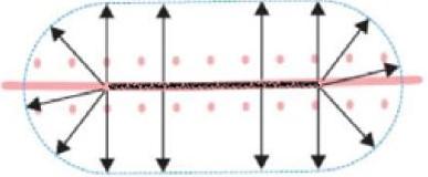 Lathund för handläggning av malignt melanom/dysplastisk naevus i Uppsala-Örebroregionen 2016-05-19 reviderad 2018-09-04 En pigmenterad förändring excideras med 2 mm klinisk marginal ned till ytliga