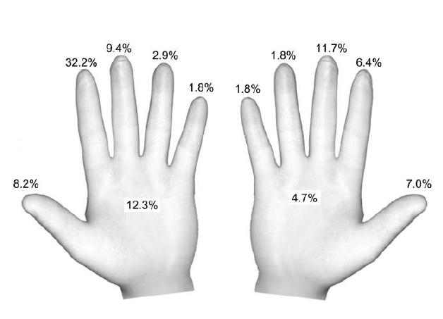 Handsken under hjärtkirurgi Partecke, LI et al.