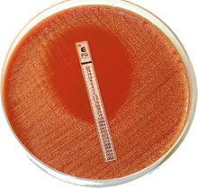 Blododlingar 5 dagar räcker Propionibakterier Vid SAB, odla om efter 72 timmar, före antibiotikados PCR-diagnostik På klaff- diskutera rutiner med baktlab På blod, ej i rutin, överväg om antibiotika