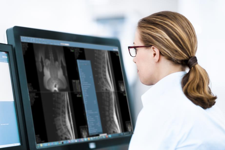 11 (23) sjukhuset Hospital for Special Surgery (HSS). Kunden beställde Sectras lösning som gör det möjligt att använda 3D-bilder vid planering av ortopediska operationer.