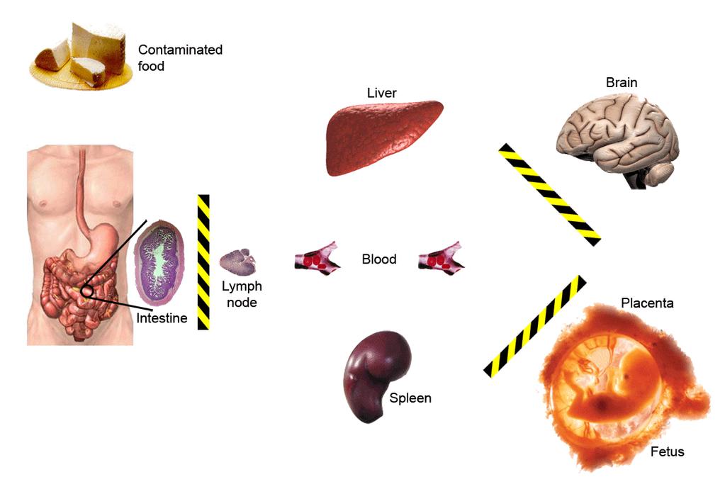 Listeria