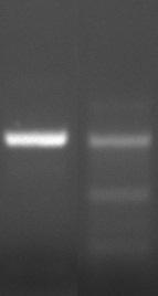 Bilaga B Problem 2 Flera PCR-produkter vid analys på agarosgel FLERA PCR-PRODUKTER MÖJLIG ORSAK LÖSNING God PCRavkast -ning Flera band PCR- För låg härdningstemperatur Kontrollera termocyklerns
